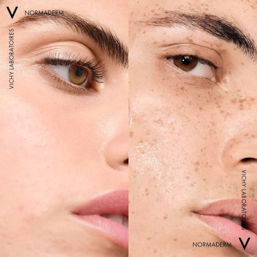 Тонік для обличчя VICHY Normaderm для звуження пор 200 мл фото 12