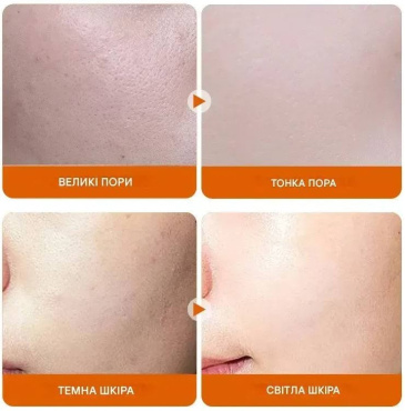 Сироватка для обличчя BIOAQUA Vitamin C White Brighten Face Serum освітлювальна з вітаміном C 30 мл фото 7