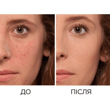 Консиллер L'Oréal Paris True Match фото 6