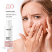 RE.CARE тонер для лица отшелушивающий Exfoliating Face Toner, 150 мл фото 1