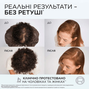 Сыворотка Elseve Growth Booster для борьбы с выпадением и ломкостью волос 102 мл фото 7