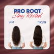 Енергетична сироватка Hair Trend Pro Root Stay Rooted для шкіри голови 50 мл фото 6
