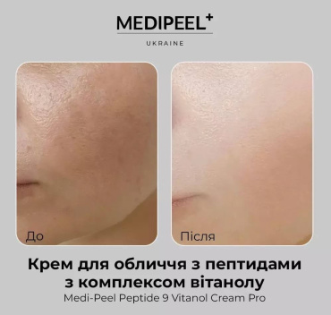 Крем для лица Medi-Peel peptide 9 vitanol cream pro с пептидами и витанолом 50 мл фото 3
