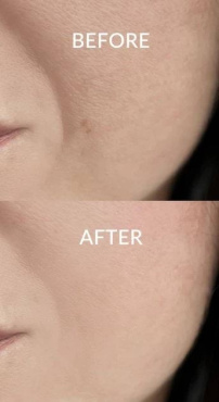 Моделирующий крем для лица Dr. Althea Rapid Firm Sculpting Cream антивозрастной 45 мл фото 5