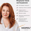 Крем для лица Medi-Peel Gold Age Tox Cream капсульный с экстрактом золотого шелкопряда 50 мл фото 6