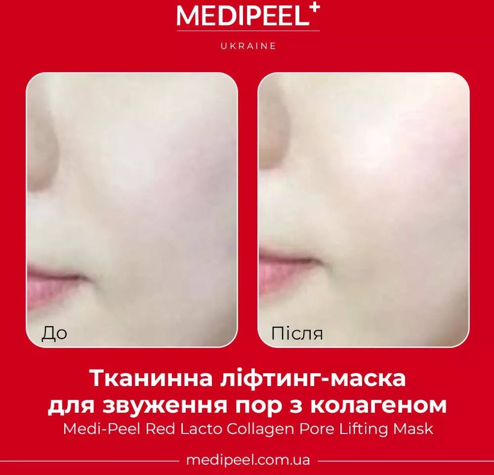 Тканинна маска для обличчя Medi-Peel Red Lacto Collagen Pore Lifting Mask з ліфтинг-ефектом 30 мл фото 3