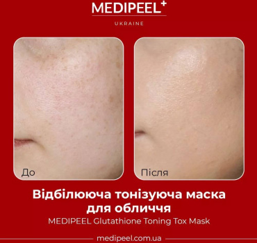 Тканевая маска для лица Medi-Peel Glutathione Toning Tox Mask отбеливающая тонизирующая 25 мл фото 4