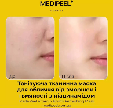 Тканинна маска для обличчя Medi-Peel Vitamin Bomb Refreshing Mask тонізувальна 25 мл фото 8