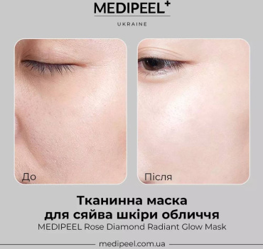 Тканинна маска для обличчя Medi-Peel Rose Diamond Radiant Glow Mask з алмазною пудрою 25 мл фото 1