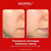 Тканинна маска для обличчя Medi-Peel Vita Toning Ampoule Mask тонізувальна 30 мл фото 3