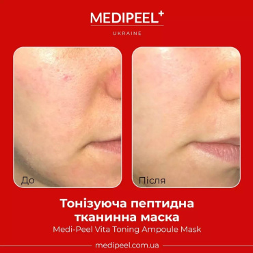Тканинна маска для обличчя Medi-Peel Vita Toning Ampoule Mask тонізувальна 30 мл фото 3