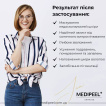 Сонцезахисний крем для обличчя Medi-Peel Active Silky Sun Cream SPF50+/PA+++, 50 мл фото 6