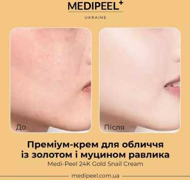 Крем для лица Medi-Peel 24k Gold Snail Repair Cream с коллоидным золотом и муцином улитки 50 мл фото 3