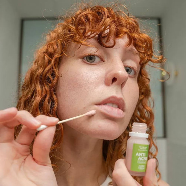 Точечное средство-концентрат Marie Fresh Cosmetics Anti Acne On-The-Spot Solution от прыщей угрей и воспалений локального действия 10 мл фото 5