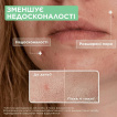 Сыворотка Mixa Anti-Imperfection Serum для проблемной чувствительной кожи с салициловой кислотой и ниацинамидом 30 мл фото 6