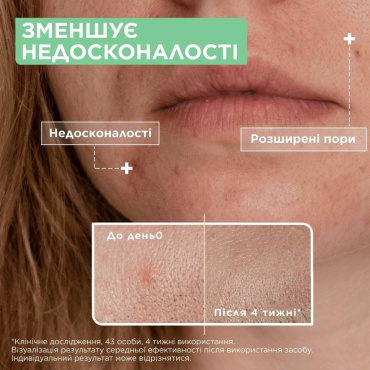 Сыворотка Mixa Anti-Imperfection Serum для проблемной чувствительной кожи с салициловой кислотой и ниацинамидом 30 мл фото 6