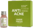Точечное средство-концентрат Marie Fresh Cosmetics Anti Acne On-The-Spot Solution от прыщей угрей и воспалений локального действия 10 мл фото 10