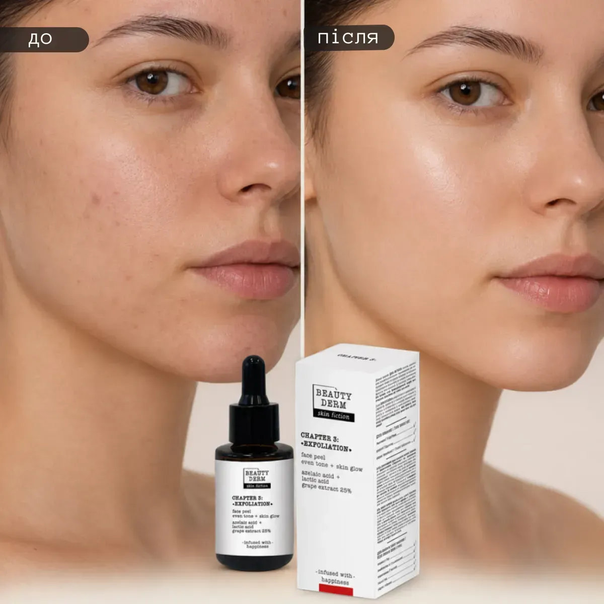 Пілінг для обличчя Beauty Derm Skin Fiction з азелаїновою кислотою та екстрактом винограду 30 мл фото 4