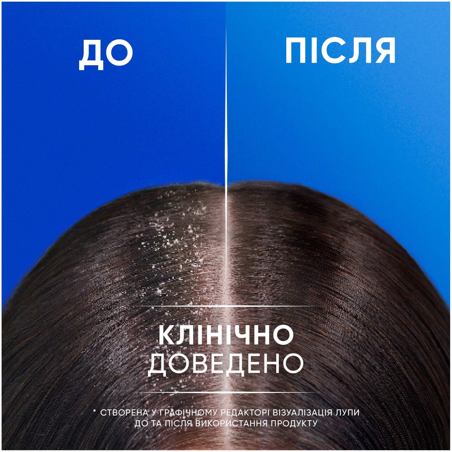 Шампунь Head & Shoulders Classic Clean против перхоти 400 мл фото 2