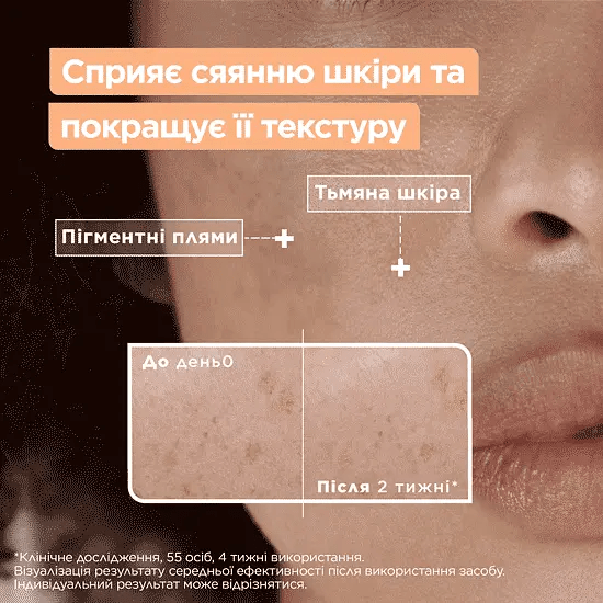 Сироватка Mixa для сяяння тьмяної чутливої шкіри обличчя 30 мл фото 7